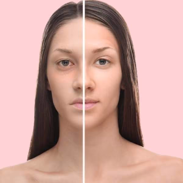 Aging