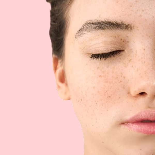 Pigmentation